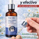 NAIL FUNGUS ESSENCE
